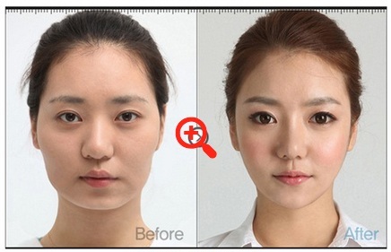 korean-plastic-surgery