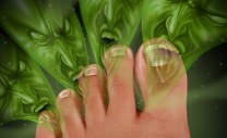 foot-fungus