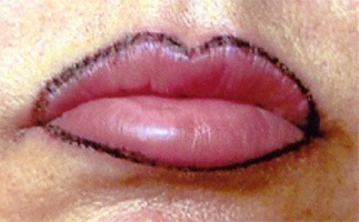 Permanent lipliner makeup disaster